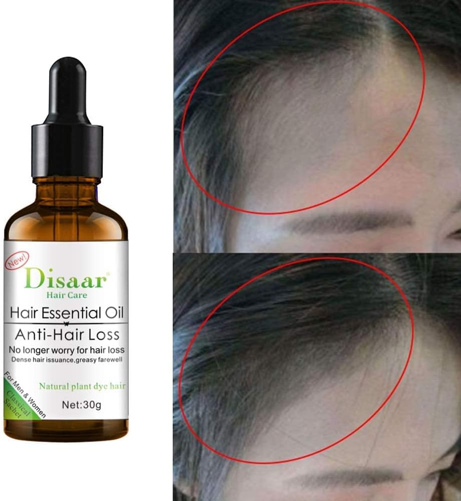 DISAAR HAIR LOSS TREATMENT ESSENTIAL OIL